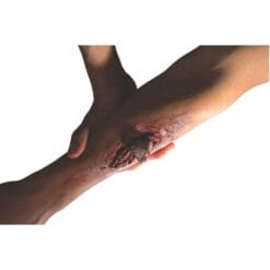 Broken Bone Theatrical Effect